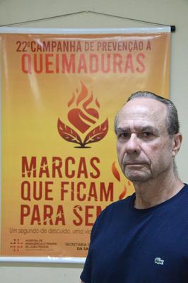 JP e CG têm 41 casos de queimaduras