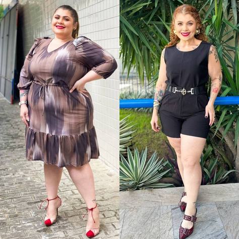 especial-obesidadeheloisa-desiree-ante-e-depois-da-bariatrica-1.jpeg