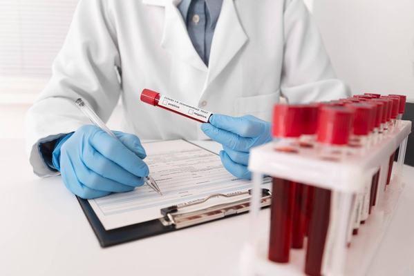 Laboratórios cobram até 400% a mais por exame