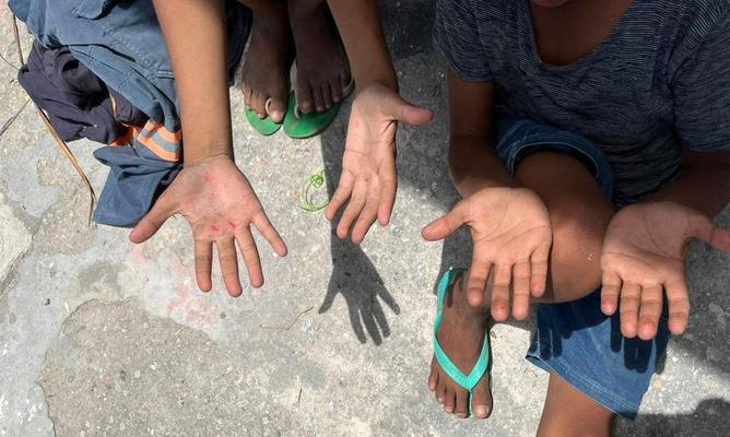 MPT reforça necessidade de reação à questão
